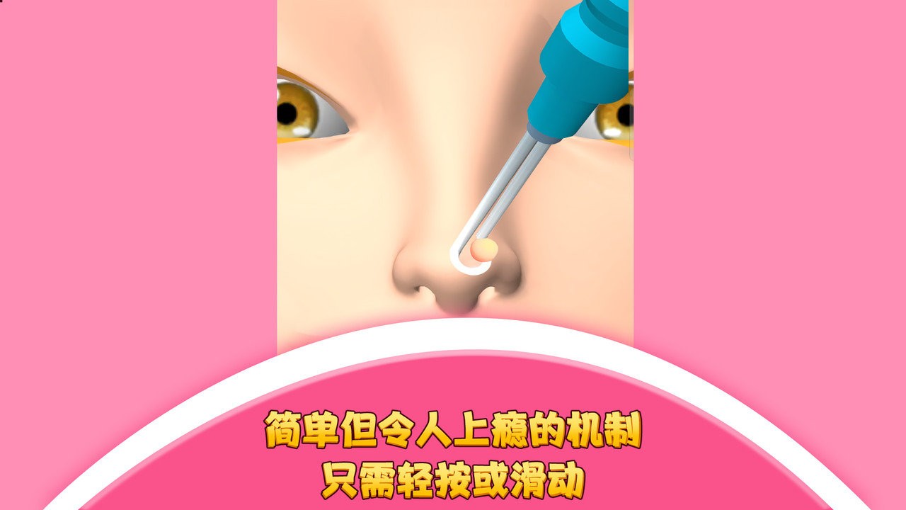 我爱挤黑头 游戏截图